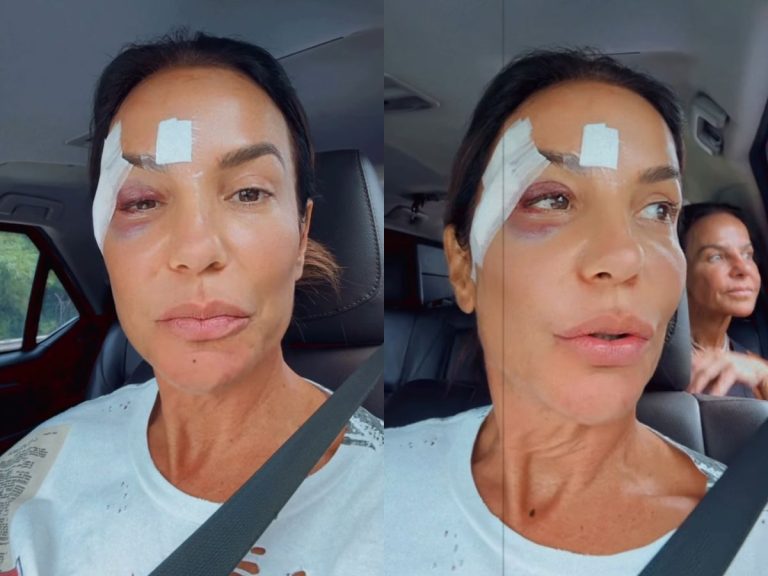 Ivete Sangalo deixa hospital após operação no rosto e volta para casa em Salvador