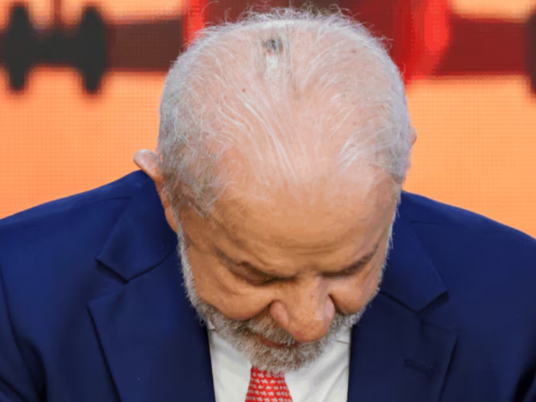 Lula inicia mais um ciclo de radioterapia no couro cabeludo após a remoção de tumor