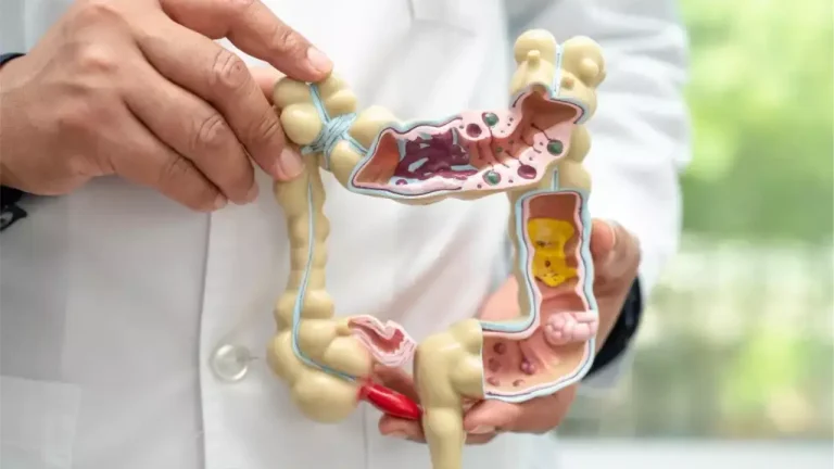 Crescimento do câncer intestinal no Brasil pede vigilância sobre os sintomas iniciais