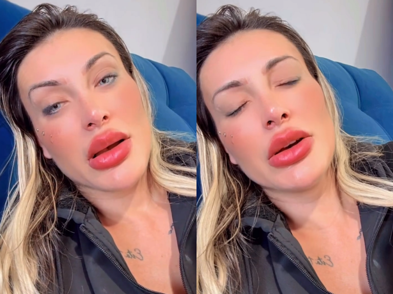 Andressa Urach compartilha sua impressionante transformação facial; confira o resultado