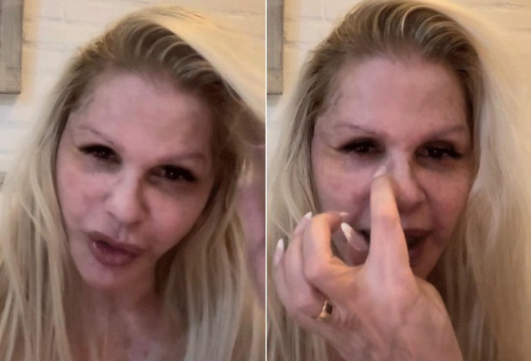 Monique Evans exibe o novo visual uma semana após a cirurgia plástica: “Estou encantada